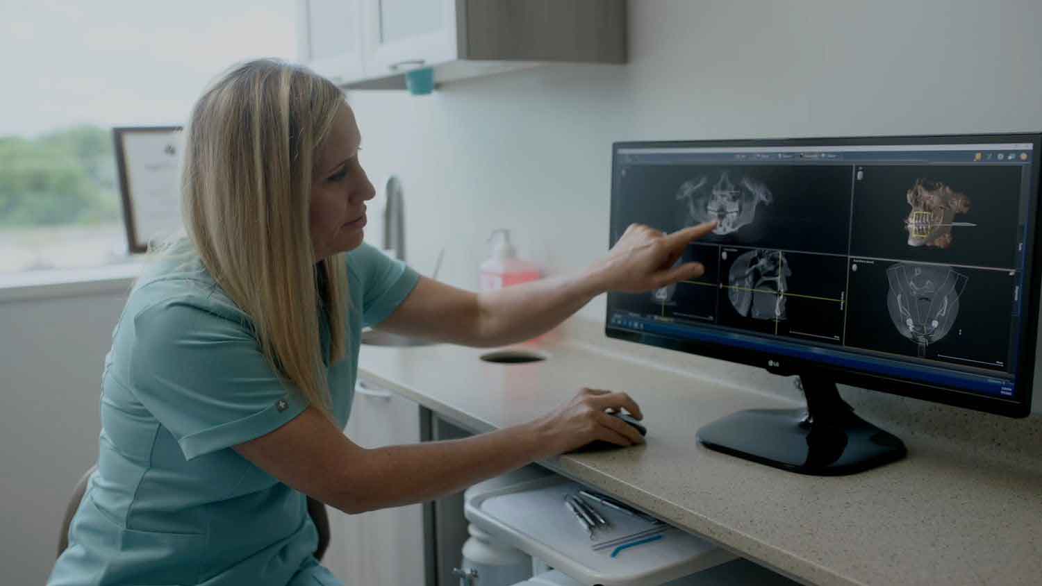 OH cincinnati full arch dental implants periodontics & implantology at cornerstone